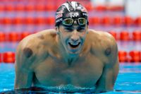 Michael Phelps med färska "sugmärken".