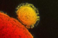 Foto: AP/NATIONAL INSTITUTE FOR ALLERGY AND INFECTIOUS DISEASES