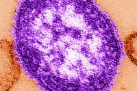 Mässling orsakas av ett extremt smittsamt virus. 26 personer har insjuknat i det senaste utbrottet. Arkivbild.