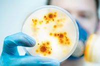 En laboratorieforskare visar upp en odling av bakterier och virus. 