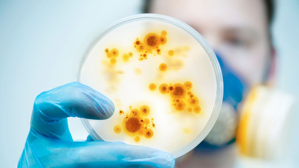 En laboratorieforskare visar upp en odling av bakterier och virus. 