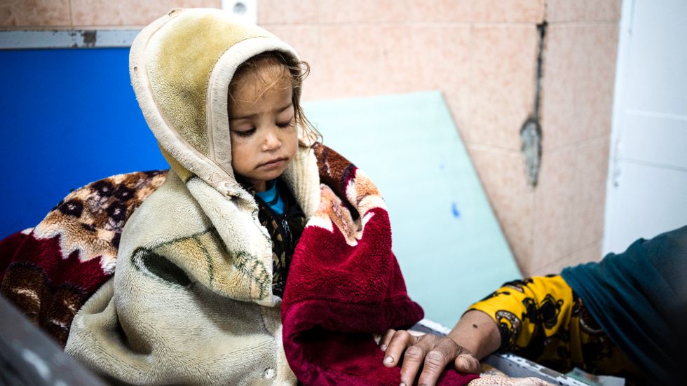 Hungersnöden i världen har förvärrats i samband med pandemin. På bilden syns 2-åriga Guldana som är undernärd och vårdas på ett sjukhus i Kabul, Afghanistan. 