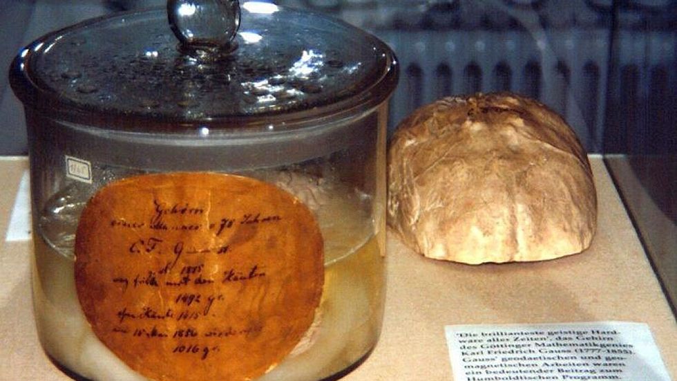 1492 gram vägde Gauss hjärna, enligt etiketten.