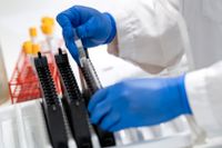 Blodprover som ska testas för antikroppar på ett labb i Lund. Men även T-celler kan ge immunitet mot covid-19 – en lång immunitet enligt en ny studie.