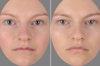 Exempelbilder från studien på ett ansikte i friskt respektive i sjukt tillstånd. 
