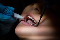 Från 2025 ändras reglerna för fri tandvård och vilka som kan få dubbelt tandvårdsbidrag. Arkivbild.