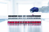 Danska biotechföretaget Bavarian Nordic är ensamt om ett vaccin som fungerar mot apkoppor. Företaget kan årligen producera minst 30 miljoner doser.