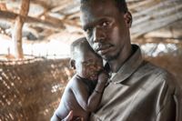 Lidandet är oerhört bland barnen i krisens Sydsudan. Här Garang Athoi med sin nio månader gamla son Kuol, som är sjuk och svårt undernärd.