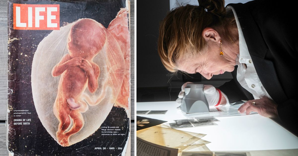 Les photos de fœtus de Lennart Nilsson n’ont pas été prises dans l’utérus – dit sa belle-fille