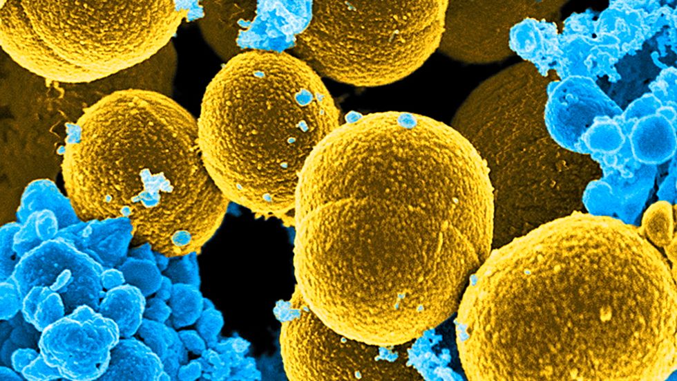 En av de farligaste arterna av bakterier, Staphylococcus aureus. Precis som andra bakterier kan de kommunicera med varandra.