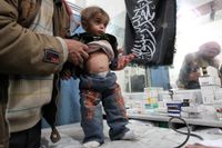 En undernärd pojke får hjälp på ett fältsjukhus i Aleppo i Syrien. Bristen på primärvård är ett stort hot mot landets befolkning. Alla barn under två år är ovaccinerade mot sjukdomar som mässling.