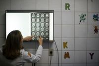 En läkare undersöker röntgenbilder av barn med misstänkt mikrocefali.