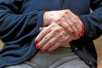 Under de senaste åren har allt mer forskning gjorts för att kartlägga de strukturella förändringar som leder till åldrande, skriver artikelförfattarna.