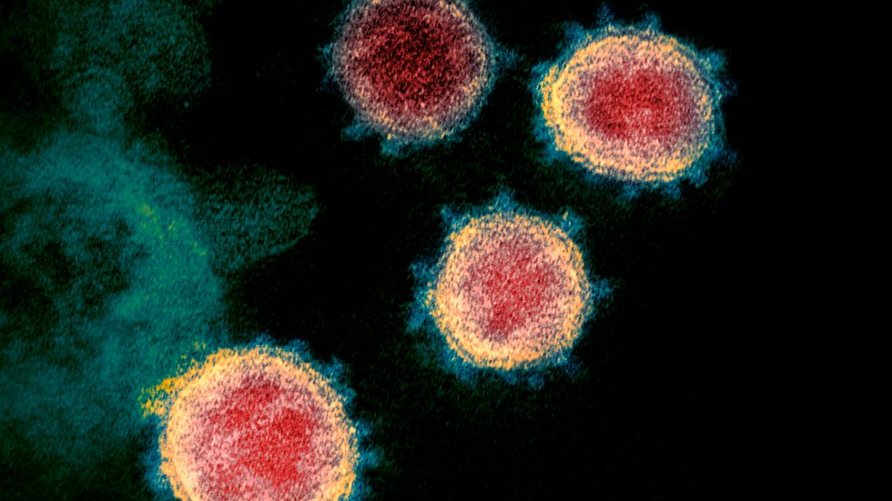 Viruset som orsakar covid-19, fotograferat med ett elektronmikroskop. Nu ska svenska forskare börja testa ett läkemedel, som i vanliga fall används i behandling av prostatacancer, mot covid-19.
