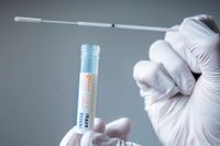 Ett test för provtagning av covid-19. Nu har forskare i Umeå tagit fram ett nytt test för att se om en person utvecklat antikroppar mot viruset.