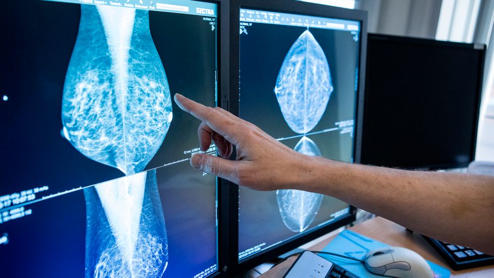 En läkare tittar på mammografibilder. Arkivbild